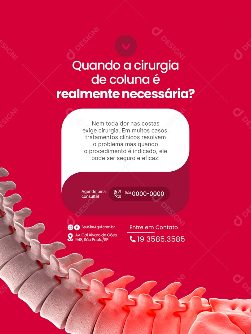 Clínica Ortopédica Quando a Cirurgia de Coluna Social Media PSD Editável