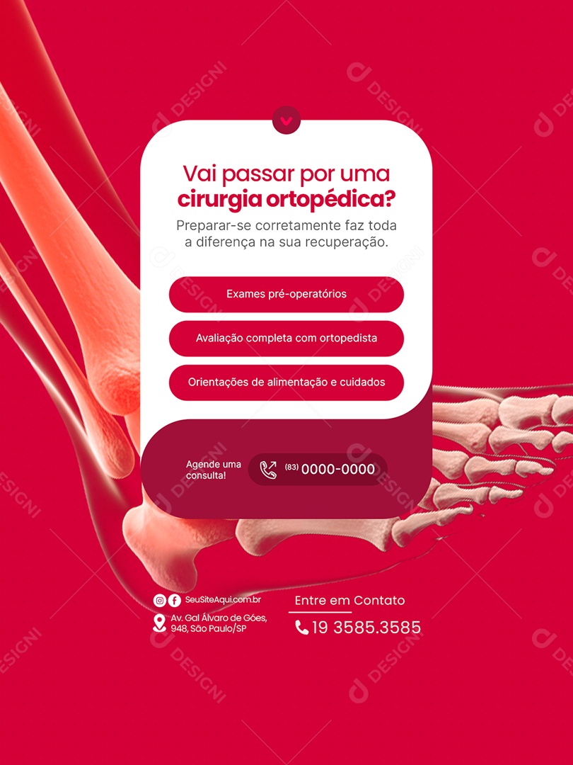Clínica Ortopédica Vai Passar por Uma Cirurgia Ortopédica Social Media PSD Editável