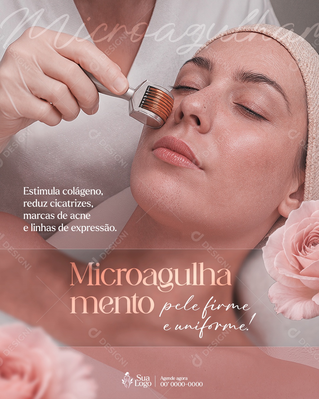 Estética Tratamento de Microagrulhamento Social Media PSD Editável