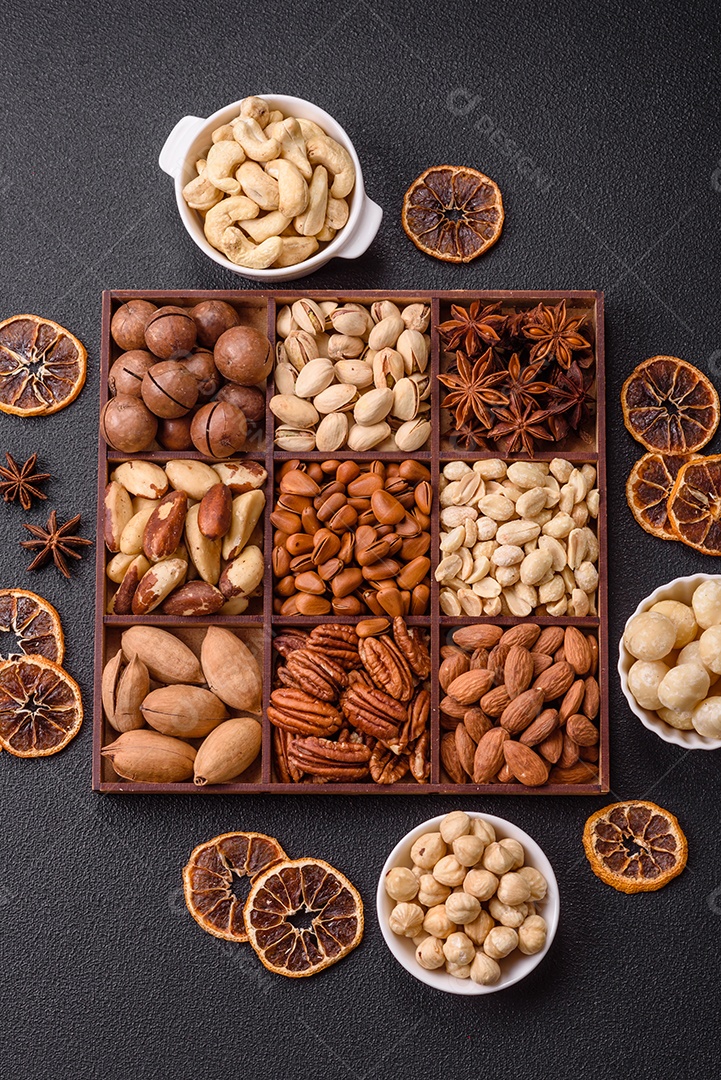 Imagem mostra uma variedade de oleaginosas, comumente chamadas de castanhas e nozes, em uma caixa dividida em compartimentos.