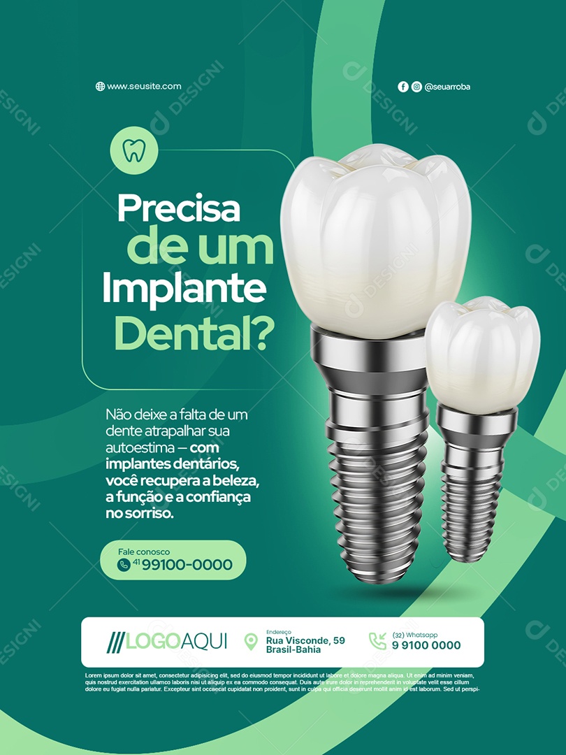 Dentista Precisa de Um Implante Dental Social Media PSD Editável