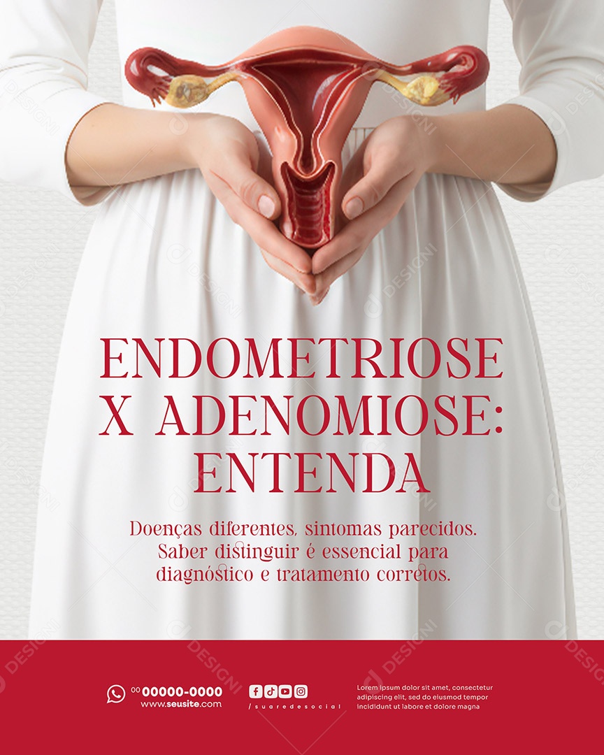 Ginecologista Endometriose X Adenomiose Social Media PSD Editável
