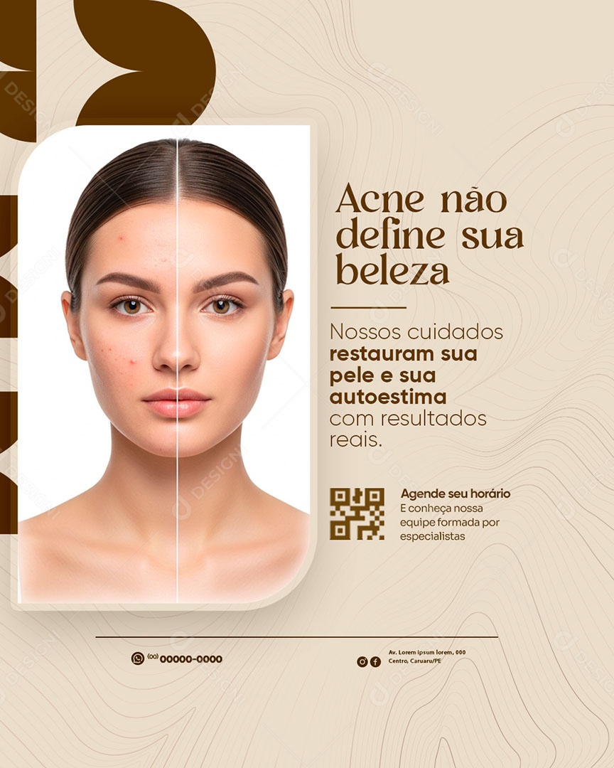 Clínicas de Estética Acne Não Define Sua Beleza Social Media PSD Editável