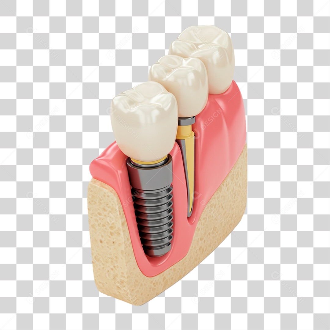 Dentadura Parte de Baixo PNG Transparente