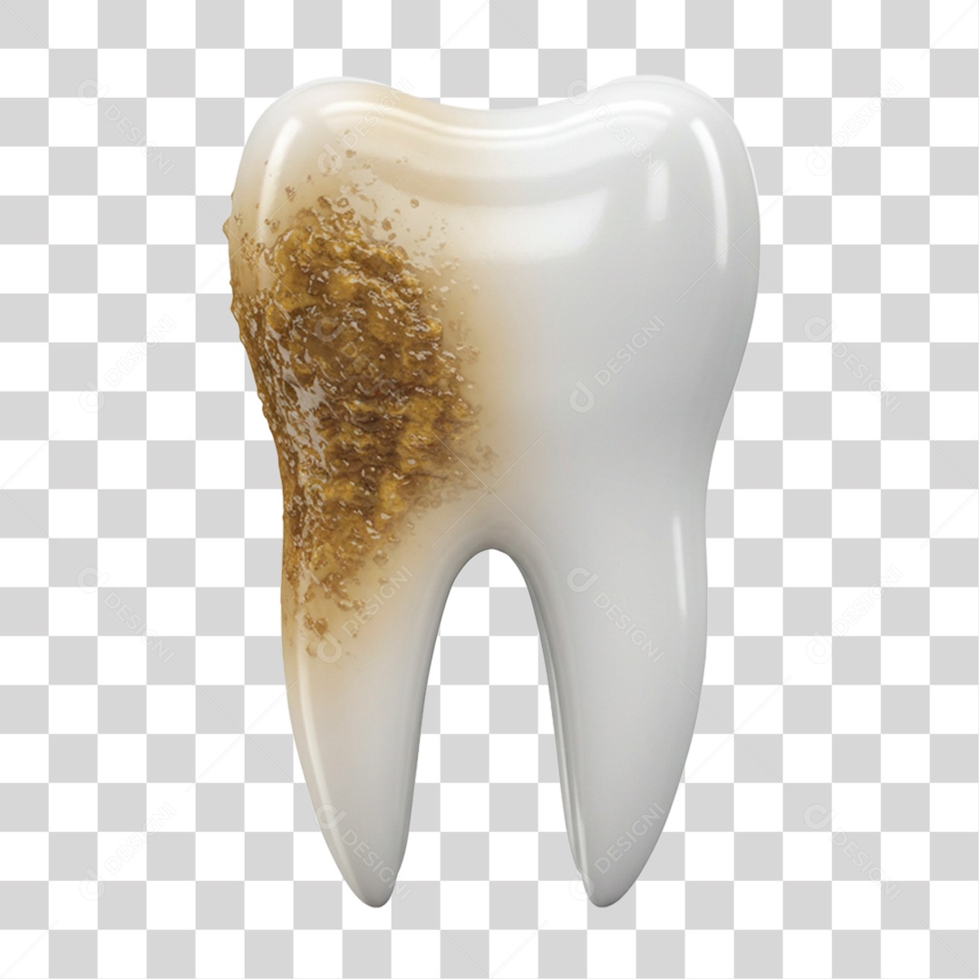 Dente Podre PNG Transparente