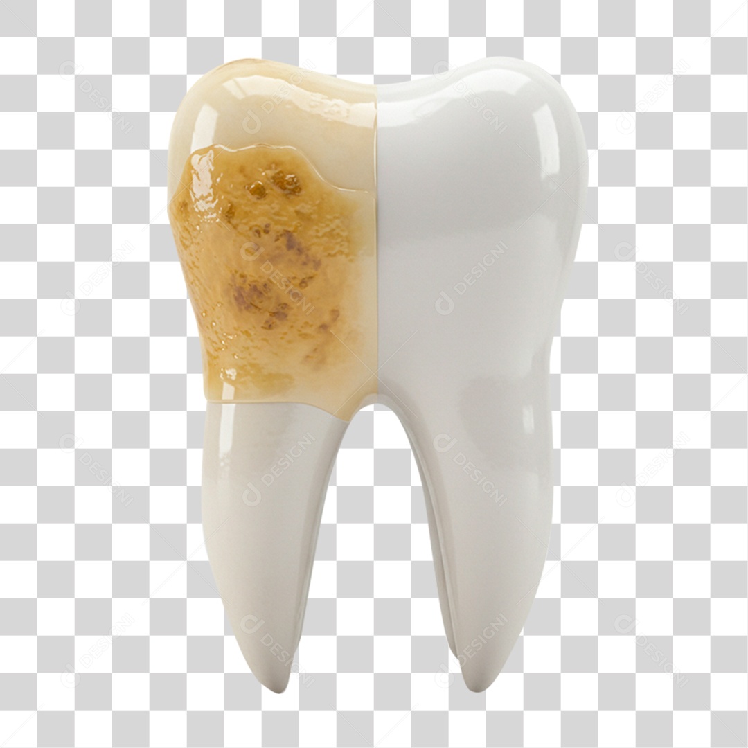 Dente Podre PNG Transparente
