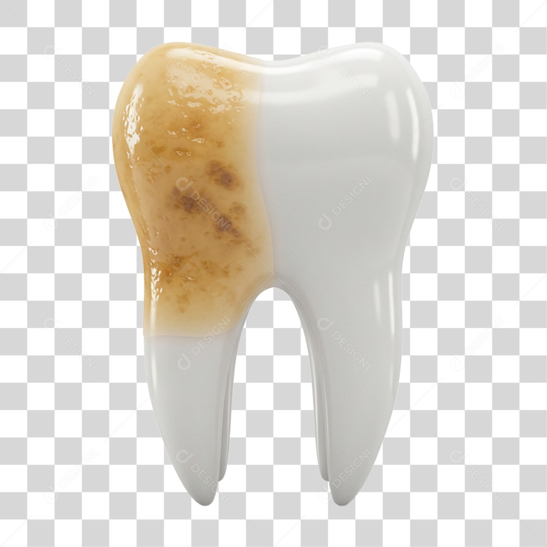 Dente Podre PNG Transparente
