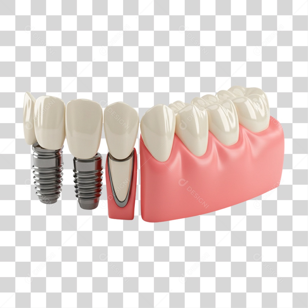 Dentadura Parte de Baixo PNG Transparente