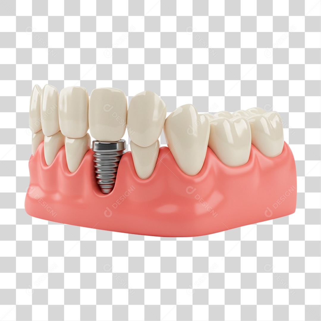 Dentadura Parte de Baixo PNG Transparente
