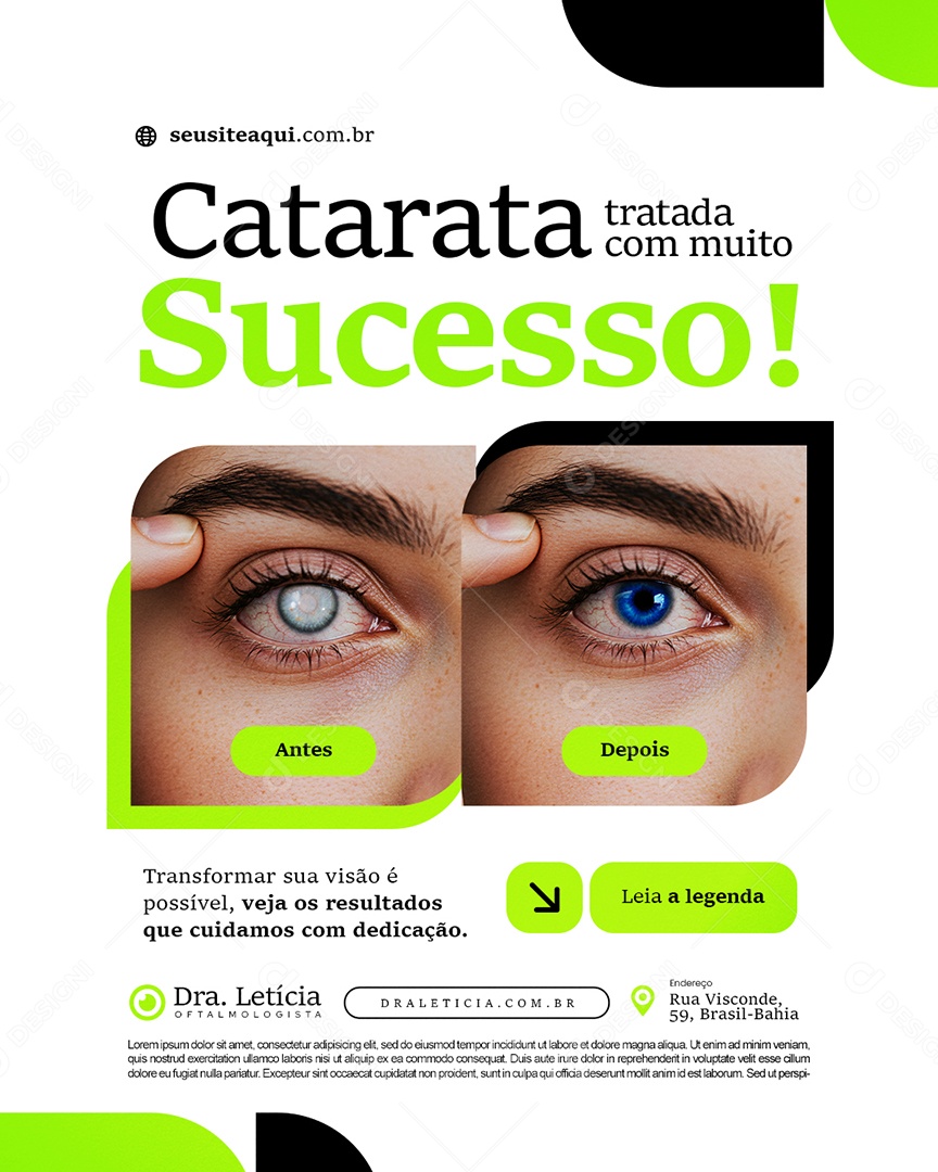 Clínica Oftalmologista Catarata Tratada com Muito Sucesso Social Media PSD Editável