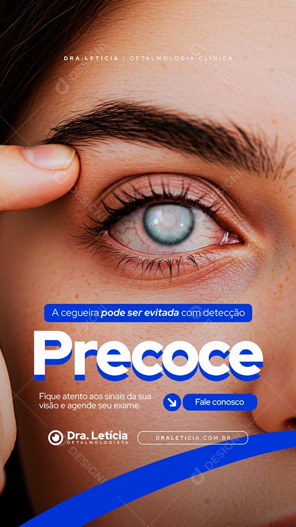 Story Clínica Oftalmologia A Cegueira Pode Ser Evitada Social Media PSD Editável