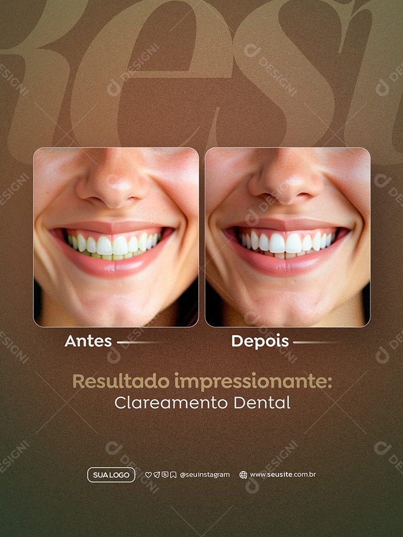 Dentista Antes e Depois Social Media PSD Editável