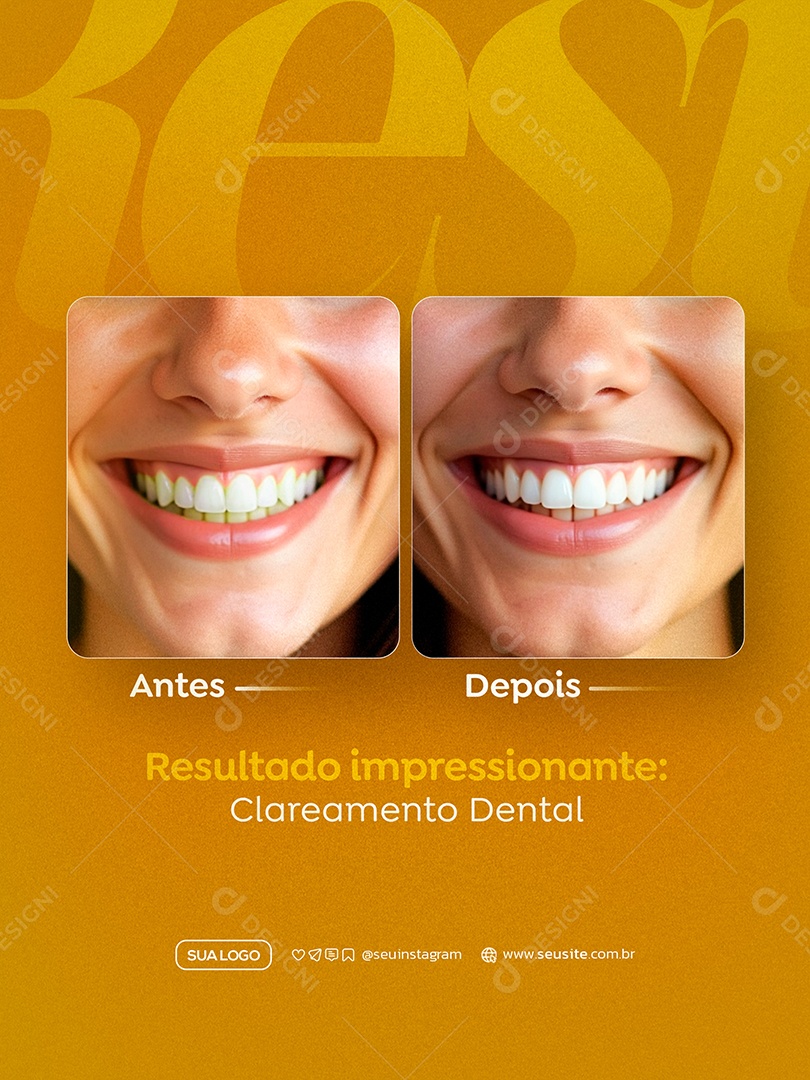 Dentista Antes e Depois Social Media PSD Editável