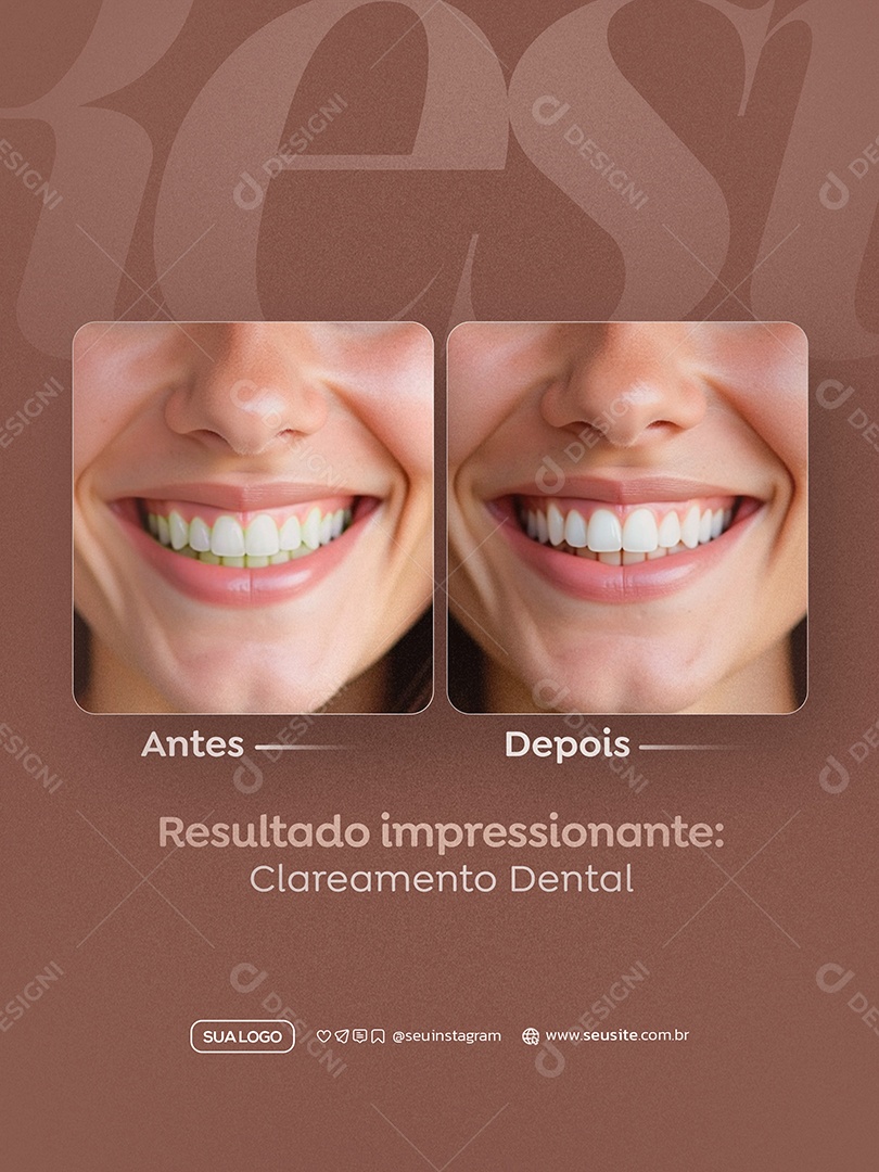 Dentista Antes e Depois Social Media PSD Editável