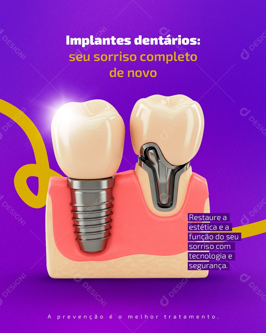 Dentista Implantes Dentários Social Media PSD Editável