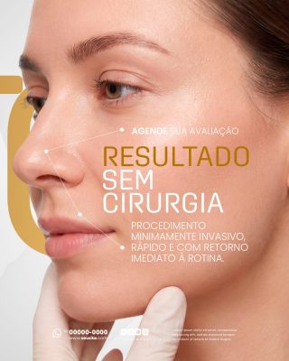 Estética Facial Resultado Sem Cirurgia Agende Sua Avaliação PSD Editável